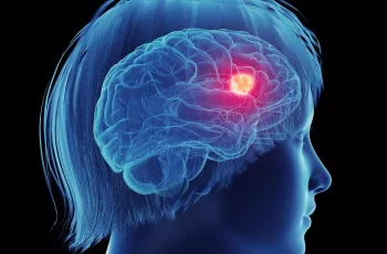 Investigating the Link Between Postmenopausal Hormone Therapy and Glioma Risk: A Critical Review Investigating the Link Between Postmenopausal Hormone Therapy and Glioma Risk: A Critical Review