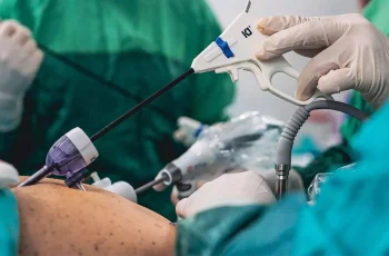 Bariatric Surgery: A Pathway to Improved Outcomes for Patients with MASH-Related Cirrhosis Bariatric Surgery: A Pathway to Improved Outcomes for Patients with MASH-Related Cirrhosis